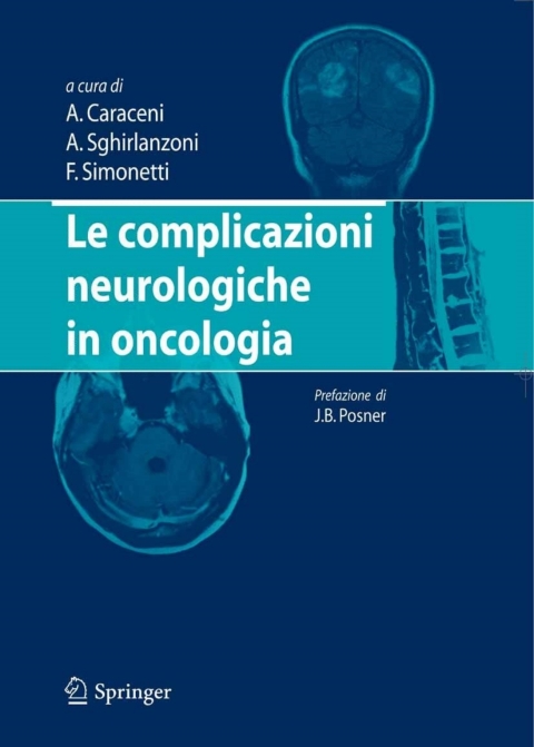 Cover image for book Le complicazioni neurologiche in oncologia