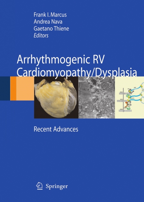 Cover image for book Arrhythmogenic RV Cardiomyopathy/Dysplasia