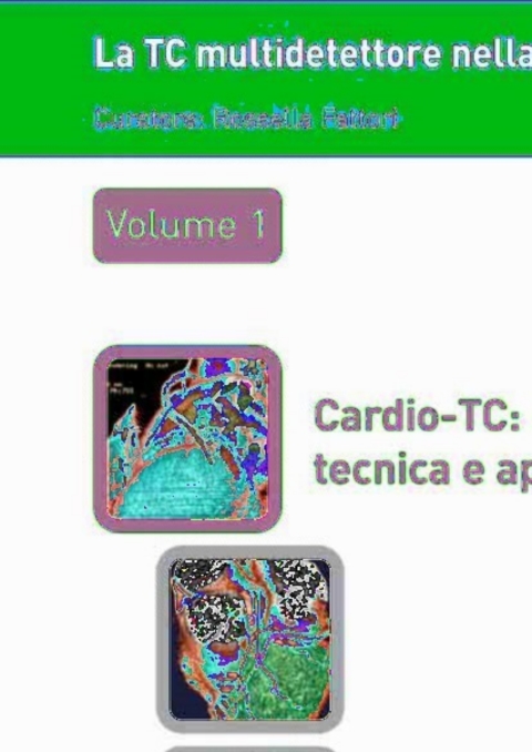 Cover image for book La TC multidetettore nella diagnostica cardiovascolare