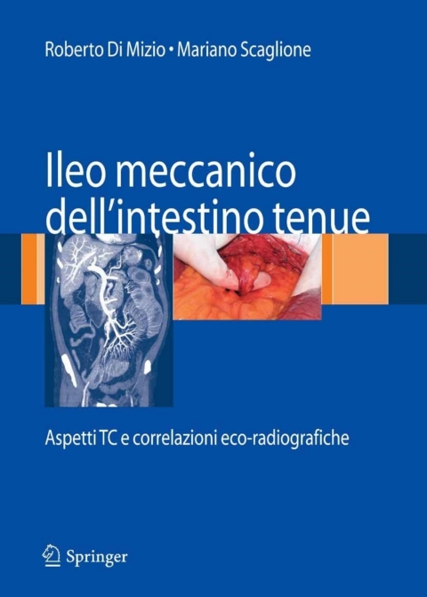 Cover image for book Ileo meccanico dell'intestino tenue