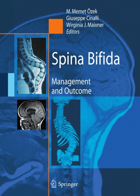 Cover image for book Spina Bifida