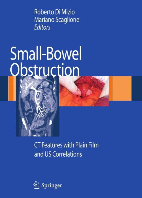 Cover image for book Small-Bowel Obstruction