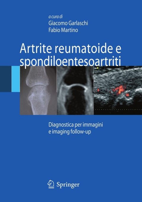 Cover image for book Artrite reumatoide e spondiloentesoartriti