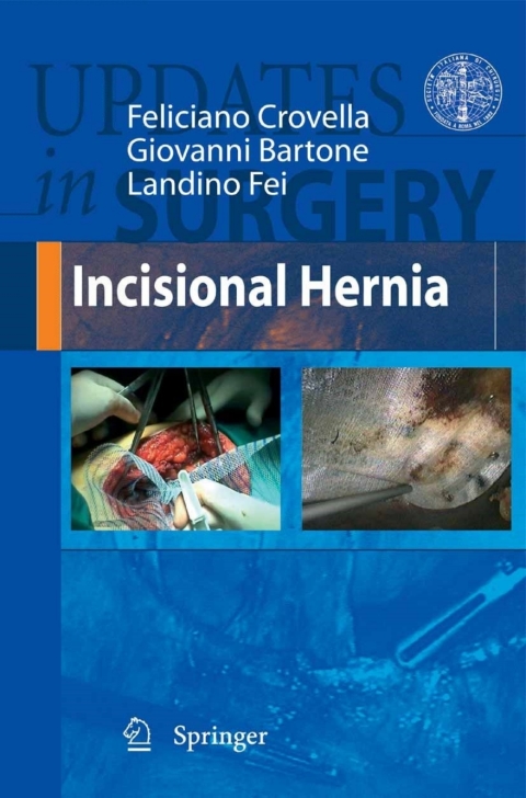 Cover image for book Incisional Hernia