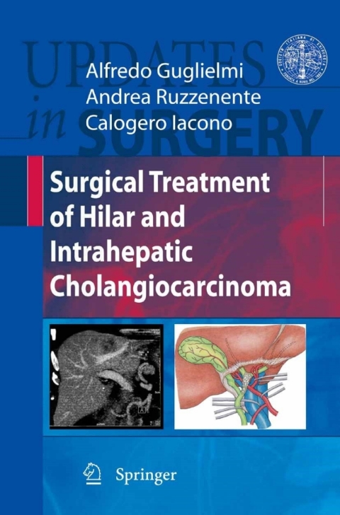 Cover image for book Surgical Treatment of Hilar and Intrahepatic Cholangiocarcinoma