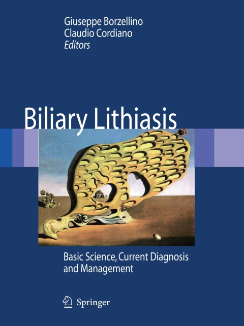 Cover image for book Biliary Lithiasis