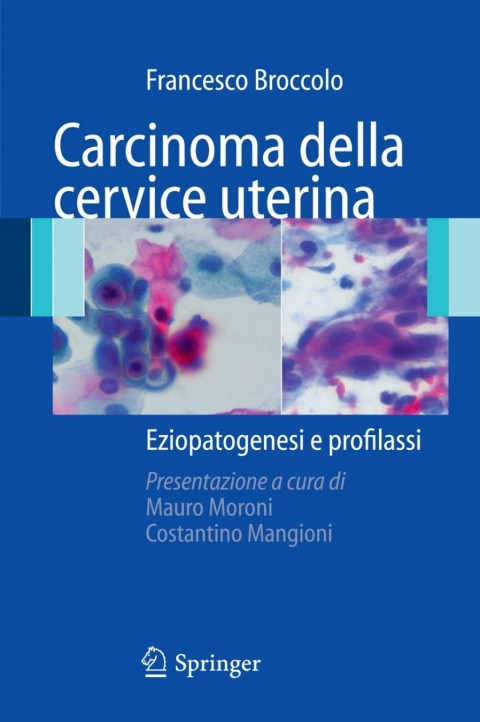 Cover image for book Carcinoma della cervice uterina