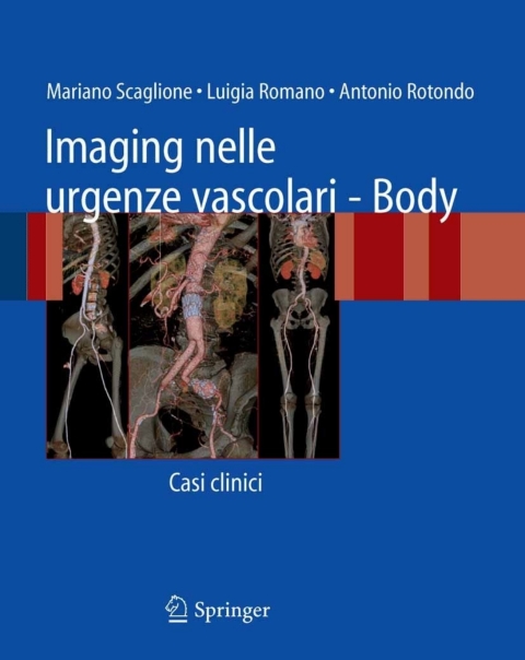 Cover image for book Imaging nelle urgenze vascolari - Body