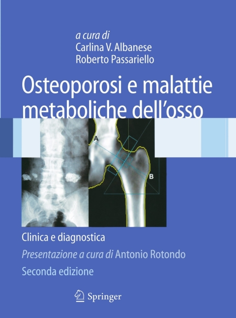 Cover image for book Osteoporosi e malattie metaboliche dell'osso