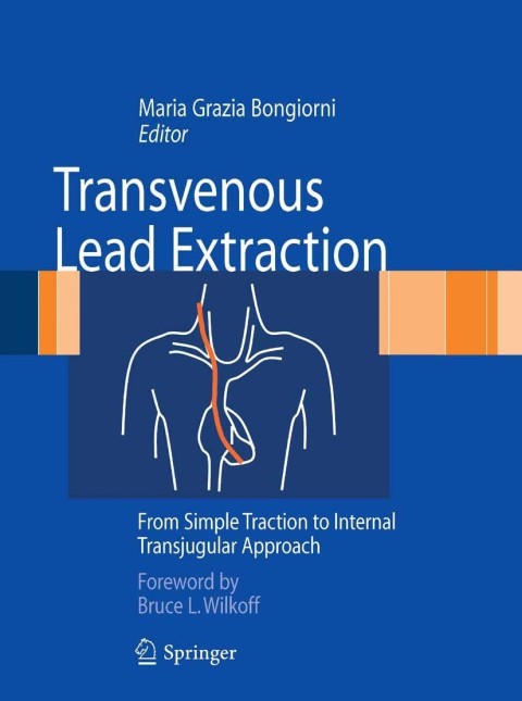 Cover image for book Transvenous Lead Extraction
