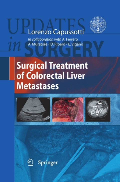 Cover image for book Surgical Treatment of Colorectal Liver Metastases