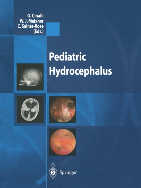 Cover image for book Pediatric Hydrocephalus