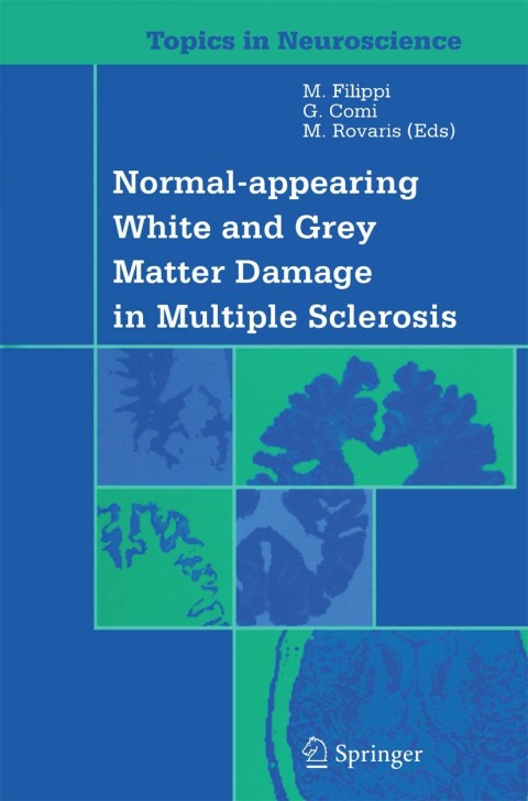 Cover image for book Normal-appearing White and Grey Matter Damage in Multiple Sclerosis