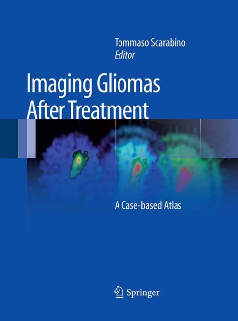 Cover image for book Imaging Gliomas After Treatment