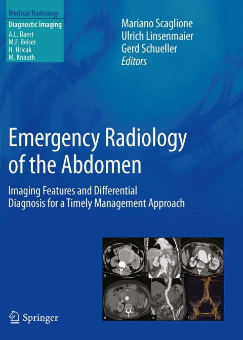 Cover image for book Emergency Radiology of the Abdomen