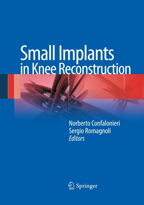 Cover image for book Small Implants in Knee Reconstruction