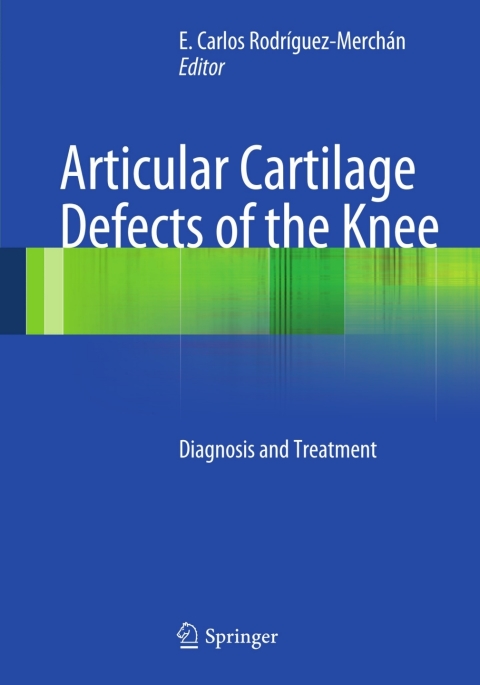 Cover image for book Articular Cartilage Defects of the Knee
