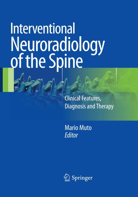 Cover image for book Interventional Neuroradiology of the Spine