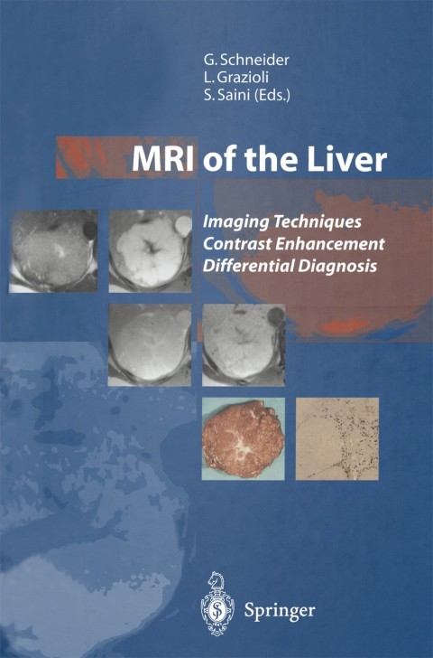 Cover image for book MRI of the Liver