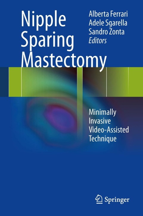 Cover image for book Nipple Sparing Mastectomy