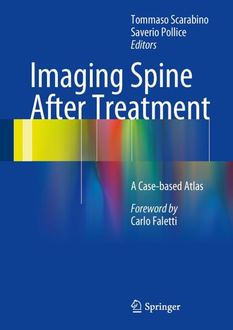 Cover image for book Imaging Spine After Treatment