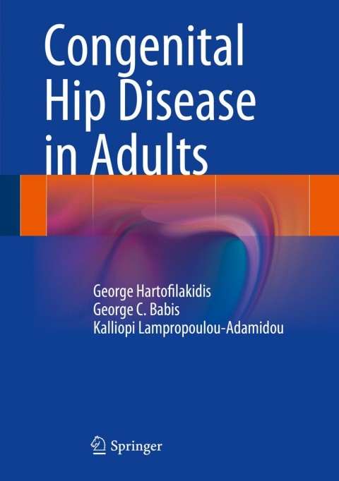 Cover image for book Congenital Hip Disease in Adults