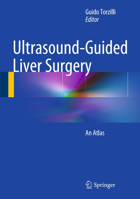 Cover image for book Ultrasound-Guided Liver Surgery