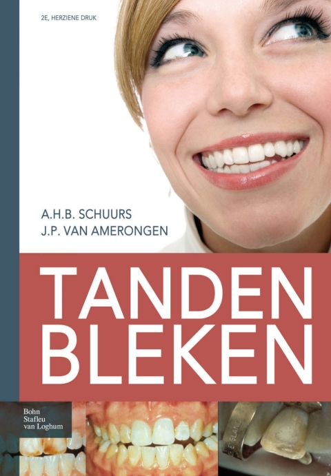 Cover image for book Tanden bleken