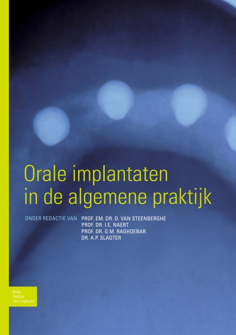 Orale implantaten in de algemene praktijk 