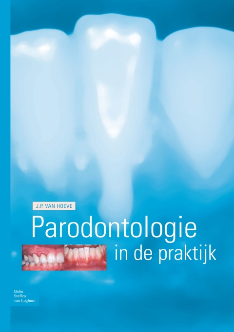 Cover image for book Parodontologie in de praktijk