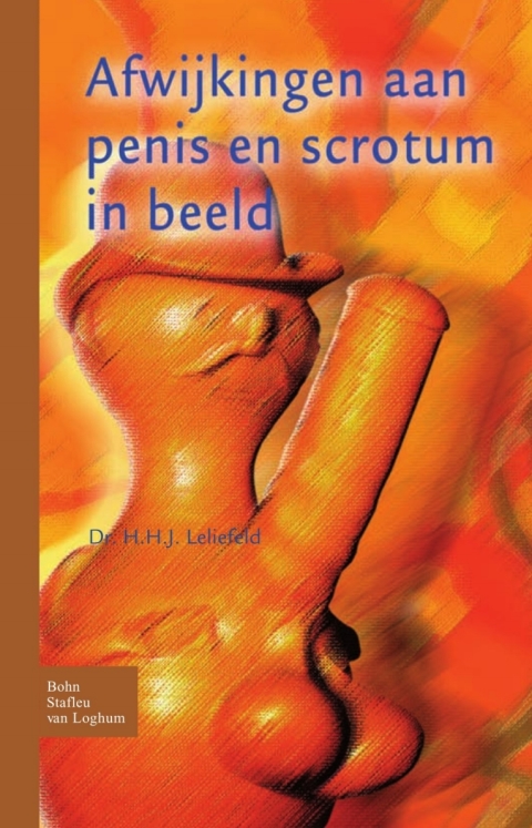 Cover image for book Afwijkingen aan penis en scrotum in beeld