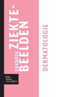Omslagafbeelding: Zakboek ziektebeelden - Dermatologie 9789031364688