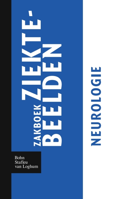 Cover image for book Zakboek ziektebeelden Neurologie