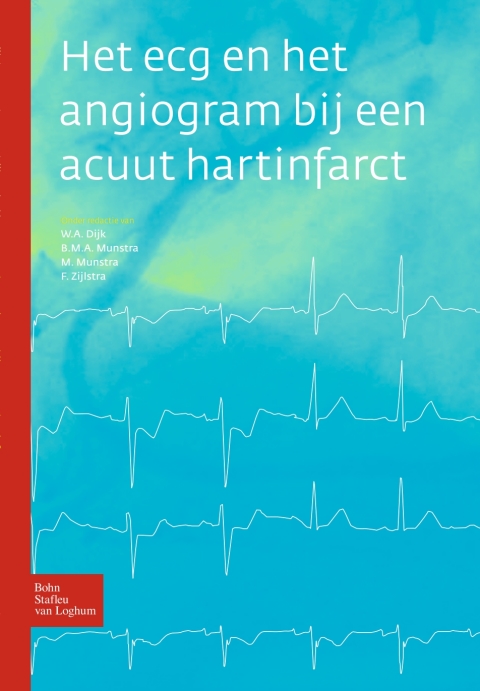 Cover image for book Het ecg en het angiogram bij een acuut hartinfarct