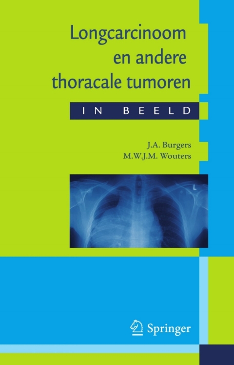 Cover image for book Longcarcinoom en andere thoracale tumoren in beeld