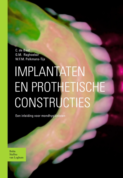 Cover image for book Implantaten en prothetische constructies
