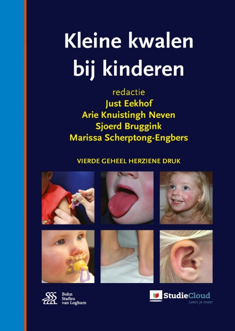 Cover image for book Kleine kwalen bij kinderen