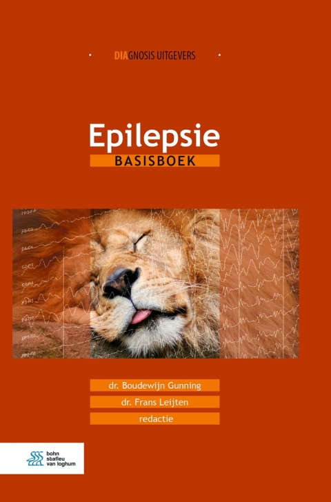 Cover image for book Epilepsie