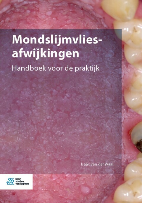 Cover image for book Mondslijmvliesafwijkingen