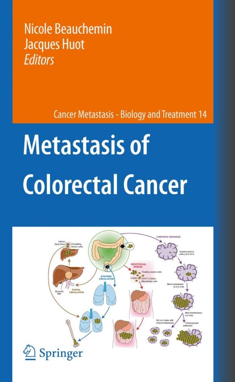 Cover image for book Metastasis of Colorectal Cancer