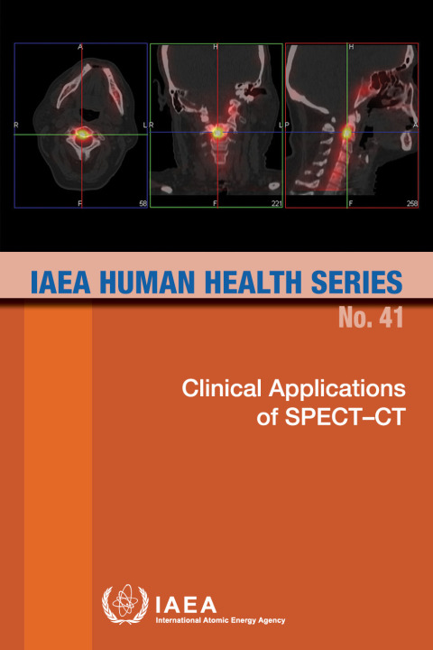 Clinical Applications of SPECT?CT 