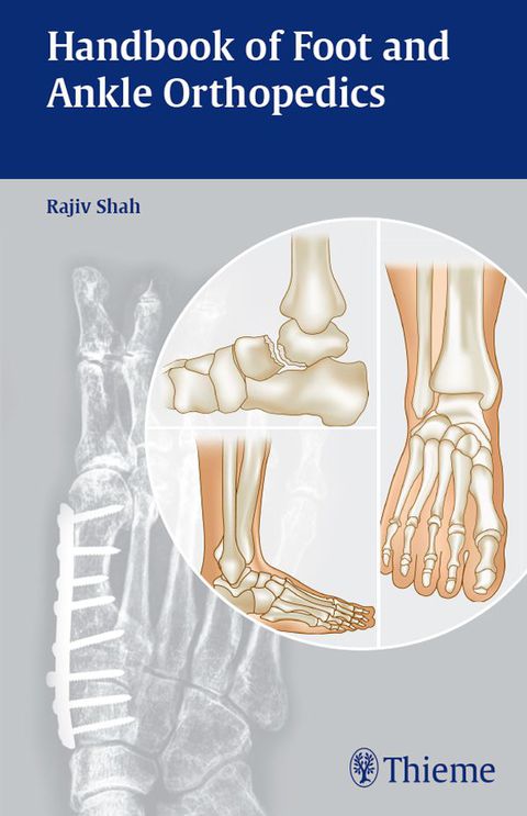 Cover image for book Handbook of Foot and Ankle Orthopedics