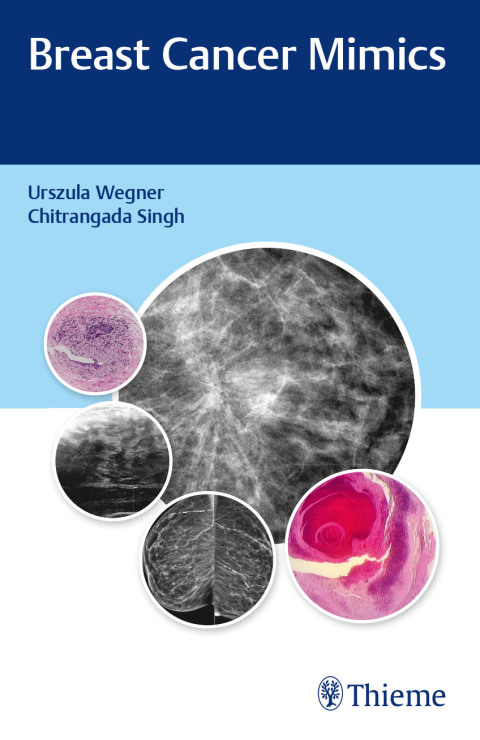 Cover image for book Breast Cancer Mimics