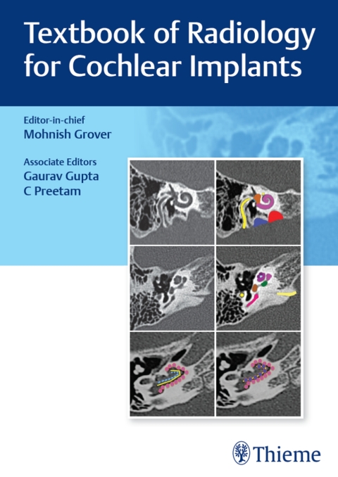Cover image for book Textbook of Radiology for Cochlear Implants