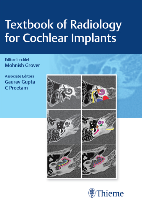 Cover image for book Textbook of Radiology for Cochlear Implants
