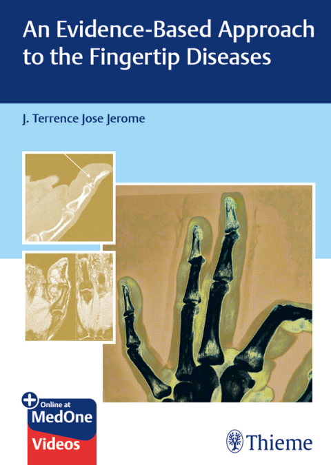 Cover image for book An Evidence-Based Approach to the Fingertip Diseases