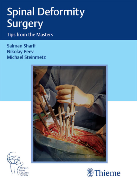 Cover image for book Spinal Deformity Surgery