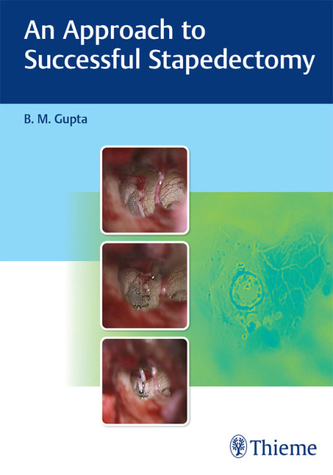 Cover image for book An Approach to Successful Stapedectomy