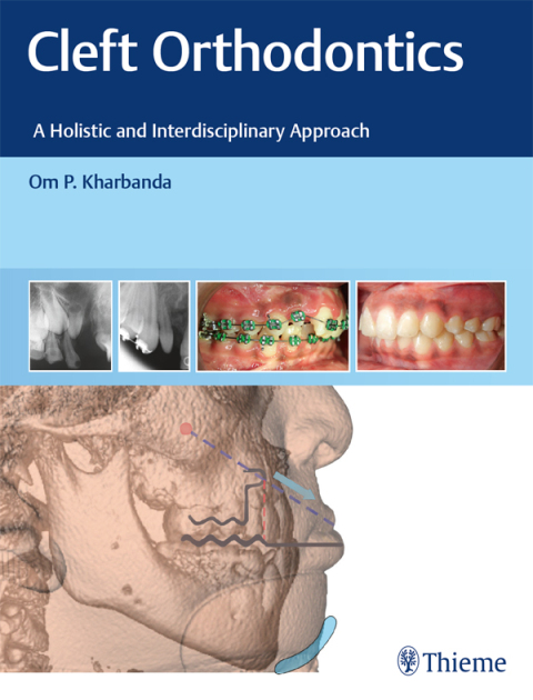 Cover image for book Cleft Orthodontics