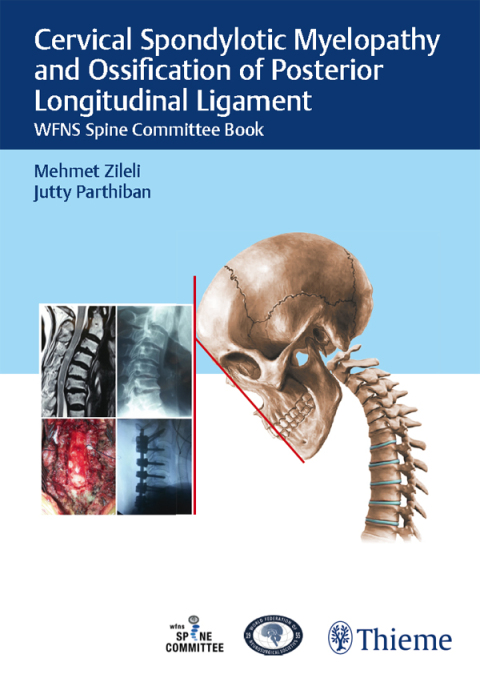 Cover image for book Cervical Spondylotic Myelopathy and Ossification of Posterior Longitudinal Ligament